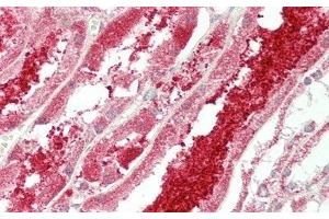Immunohistochemistry (IHC) image for anti-Chemokine (C-X3-C Motif) Ligand 1 (CX3CL1) (AA 25-332) antibody (ABIN7438127)