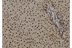 ABIN6278580 at 1/100 staining Rat liver tissue by IHC-P. (HIST1H2BH 抗体  (N-Term))