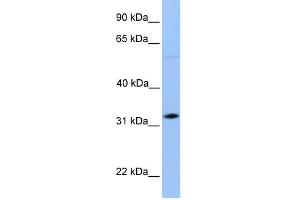 WB Suggested Anti-DNALI1 Antibody Titration: 0. (DNALI1 抗体  (C-Term))