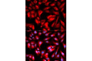 Immunofluorescence analysis of U2OS cells using CD168/RHAMM antibody (ABIN6131278, ABIN6141879, ABIN6141880 and ABIN6216074). (HMMR 抗体  (AA 1-300))