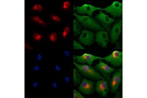 ABIN7094501 and ABIN7098550 staining  cells by IF/ICC. (PRDM16 抗体  (Internal Region))