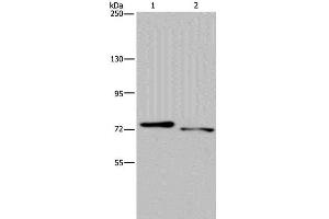 Western Blot analysis of Mouse heart and skeletal muscle tissue using NLRP10 Polyclonal Antibody at dilution of 1:300