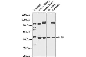 Western blot analysis of extracts of various cell lines, using PLAU antibody (ABIN3023141, ABIN3023142, ABIN3023143 and ABIN6219409) at 1:1000 dilution. (PLAU 抗体  (AA 20-180))