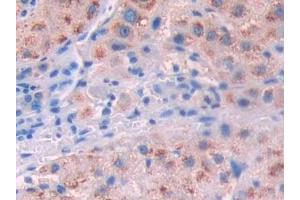 Immunohistochemistry (IHC) image for anti-Interleukin 10 Receptor, alpha (IL10RA) (AA 132-235) antibody (ABIN7433870)