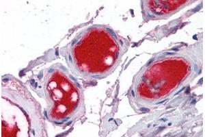 Small intestine, vessels: Formalin-Fixed, Paraffin-Embedded (FFPE) (Coagulation Factor X 抗体)