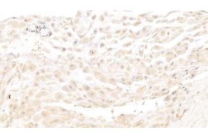Detection of MBP in Human Placenta Tissue using Monoclonal Antibody to Major Basic Protein (MBP) (Major Basic Protein 抗体  (AA 105-222))