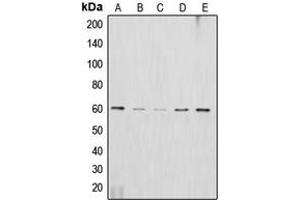 Western blot analysis of AKT2 expression in HeLa (A), HepG2 (B), NIH3T3 (C), mouse brain (D), rat brain (E) whole cell lysates. (AKT2 抗体  (C-Term))