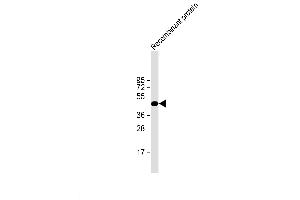 H1L recombinant protein probed with H1L (20CT26. (Tyr/ser Protein Phosphatase 抗体)