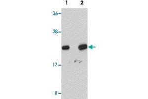 Western blot analysis of human liver tissue with NDUFB9 polyclonal antibody  at (Lane 1) 1 and (Lane 2) 2 ug/mL dilution. (NDUFB9 抗体  (C-Term))