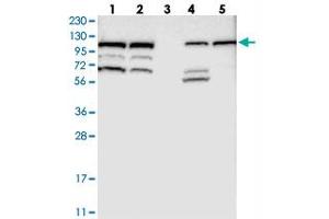Western blot analysis of Lane 1: RT-4, Lane 2: U-251 MG, Lane 3: Human Plasma, Lane 4: Liver, Lane 5: Tonsil with RASGRF2 polyclonal antibody . (Ras Protein-Specific Guanine Nucleotide-Releasing Factor 2 (RASGRF2) 抗体)