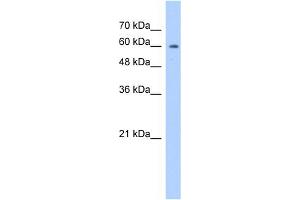 WB Suggested Anti-ATIC Antibody Titration:  1. (ATIC 抗体  (N-Term))