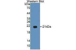 Western blot analysis of the recombinant protein. (GAS6 抗体  (AA 503-664))