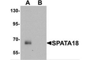 Western blot analysis of SPATA18 in rat lung tissue lysate with SPATA18 antibody at 1 ug/mL in (A) the absence and (B) the presence of blocking peptide (SPATA18 抗体  (N-Term))