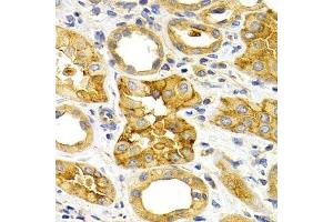 Immunohistochemistry of paraffin-embedded human kidney using CXCR3 Antibody. (CXCR3 抗体)