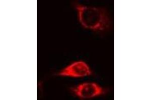 ABIN6275640 staining Hela cells by IF/ICC. (MTERF 抗体  (Internal Region))