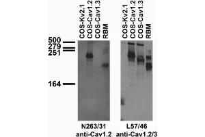 Tissue and transfected cell immunoblot: extracts of rat brain membrane (RBM) and COS cells transiently transfected with untagged Cav1.
