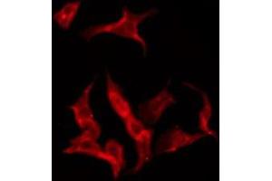Immunofluorescence (fixed cells) (IF/ICC) image for anti-Solute Carrier Family 24 (Sodium/potassium/calcium Exchanger), Member 1 (SLC24A1) (N-Term) antibody (ABIN6259203)