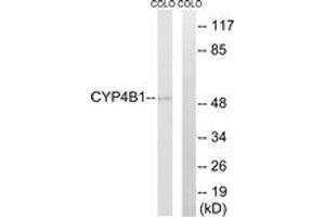 Western blot analysis of extracts from COLO cells, using Cytochrome P450 4B1 Antibody. (CYP4B1 抗体  (AA 141-190))