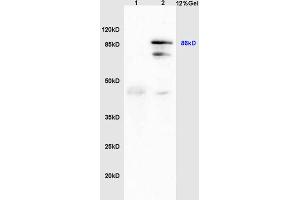 L1 human colon carcinoma lysates, L2 mouse liver lysates probed with Anti GRP94/HSP GP96 Polyclonal Antibody, Unconjugated (ABIN726125) at 1:200 in 4 °C.