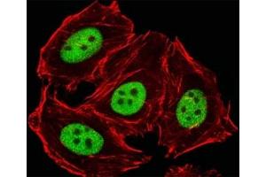 Fluorescent image of HeLa cells stained with GLI2 antibody diluted at 1:25 dilution.