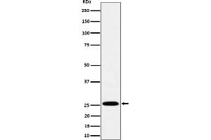 Western blot analysis of TEMT expression in A549 cell lysate.