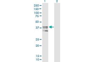 Western Blot analysis of ART4 expression in transfected 293T cell line by ART4 MaxPab polyclonal antibody. (ART4 抗体  (AA 1-314))