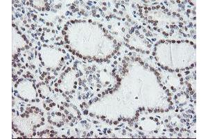 Image no. 1 for anti-Negative Regulator of Ubiquitin-Like Proteins 1 (NUB1) (AA 1-326) antibody (ABIN1490743) (NUB1 抗体  (AA 1-326))