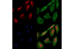 Phospho-MAP3K3 (Ser166) Antibody staining A549 cells(H2O2 treatment) by IF/ICC. (MAP3K3 抗体  (pSer166))