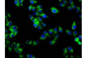 Immunofluorescence staining of Hela cells with ABIN7167381 at 1:133, counter-stained with DAPI. (RAB7B 抗体  (AA 100-199))