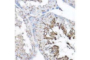 Immunohistochemistry (IHC) image for anti-Guanine Nucleotide Binding Protein (G Protein), beta Polypeptide 2 (GNB2) (AA 1-340) antibody (ABIN6141223)