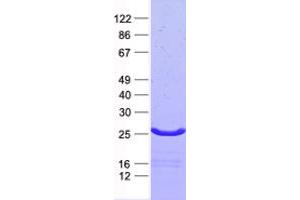 Western Blotting (WB) image for Activating Transcription Factor 3 (ATF3) protein (His tag) (ABIN2715021)