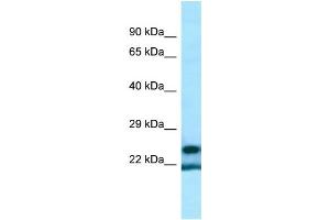 WB Suggested Anti-YRDC Antibody Titration: 1. (YRDC 抗体  (Middle Region))
