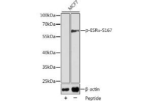 Western blot analysis of extracts from MCF7 cells using Phospho-ESRα-S167 antibody (ABIN3020207, ABIN3020208, ABIN3020209 and ABIN7101869). (Estrogen Receptor alpha 抗体  (pSer167))