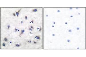 Immunohistochemistry analysis of paraffin-embedded human brain, using DARPP-32 (Phospho-Thr34) Antibody.