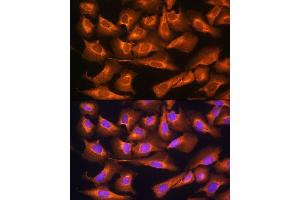 Immunofluorescence analysis of U2OS cells using RPS28 Rabbit pAb (ABIN7270024) at dilution of 1:100. (RPS28 抗体)