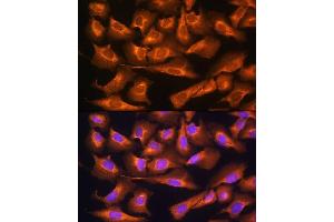 Immunofluorescence analysis of U2OS cells using RPS28 Rabbit pAb (ABIN7270024) at dilution of 1:100. (RPS28 抗体)