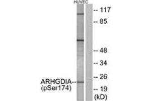 Western Blotting (WB) image for anti-rho GDP Dissociation Inhibitor (GDI) alpha (ARHGDIA) (AA 140-189), (pSer174) antibody (ABIN1531733)