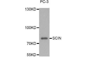Western blot analysis of extracts of PC-3 cell line, using SCIN antibody. (Scinderin 抗体)