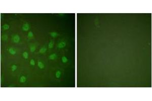 Immunofluorescence analysis of HeLa cells, using POLR2A (Ab-1619) Antibody. (POLR2A/RPB1 抗体  (AA 1585-1634))