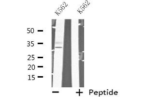 Western blot analysis of extracts from K562 cells, using MAD2L1BP antibody. (MAD2L1BP 抗体  (N-Term))