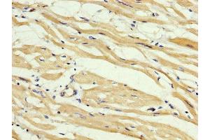IHC image of ABIN7160149 diluted at 1:400 and staining in paraffin-embedded human heart tissue performed on a Leica BondTM system. (ABHD6 抗体  (AA 105-211))