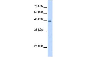 KYNU antibody used at 5 ug/ml to detect target protein. (KYNU 抗体)