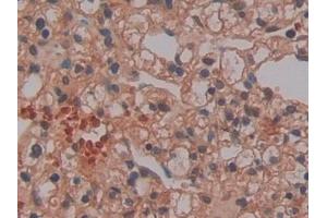Immunohistochemistry (IHC) image for anti-Proteinase 3 (PRTN3) (AA 71-247) antibody (ABIN7433627)