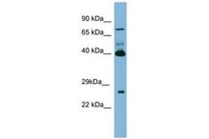 Image no. 1 for anti-Transglutaminase 3 (E Polypeptide, Protein-Glutamine-gamma-Glutamyltransferase) (TGM3) (N-Term) antibody (ABIN6741686) (TGM3 抗体  (N-Term))