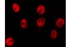 ABIN6275658 staining HepG2 by IF/ICC. (USP44 抗体  (Internal Region))