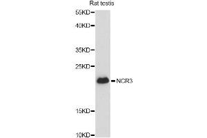 Western blot analysis of extracts of rat testis, using CALM3 antibody (ABIN6294040) at 1:3000 dilution. (Calmodulin 3 抗体)