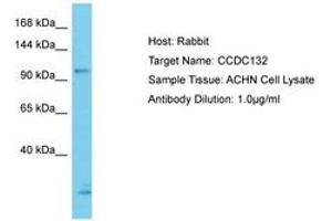 Image no. 1 for anti-Coiled-Coil Domain Containing 132 (CCDC132) (N-Term) antibody (ABIN6750636) (Syndetin/VPS50 抗体  (N-Term))