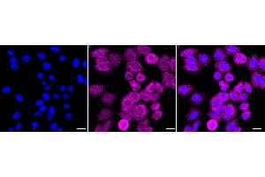 Immunocytochemical staining of HepG2 cells with Desmoplakin antibody (ABIN7798318), 1:1,000).