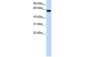 WB Suggested Anti-CCDC11 Antibody Titration: 0.