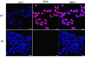 Immunocytochemical staining of HeLa cells using DDX5 antibody (ABIN7798288), 1:1,000), Top panel: wild-type (WT), Bottom panal: DDX5 shRNA knockdown (KD). (Recombinant DDX5 抗体)